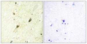 Immunohistochemical analysis of paraffin-embedded human brain tissue using Anti-GLI-3 Antibody. The right hand panel represents a negative control, where the antibody was pre-incubated with the immunising peptide