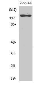 Western blot analysis of COLO205 cells using Anti-ST5 Antibody