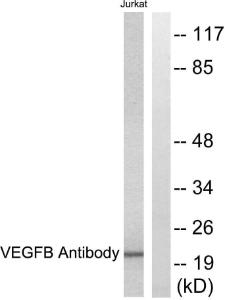 Anti-VEGFB 167 Rabbit Polyclonal Antibody