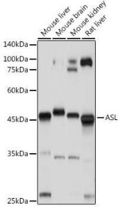 Antibody anti-ASL 100 µl