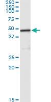 Anti-CPA2 Antibody Pair