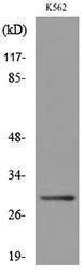 Western blot analysis of lysate from K562 cells using Anti-VDAC1 Antibody