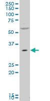 Anti-PEX7 Mouse Polyclonal Antibody