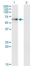 Anti-ACD Mouse Monoclonal Antibody [clone: 1C11-1A7]