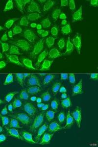 Immunofluorescence analysis of U2OS cells using Anti-MTX1 / MTX Antibody (A306624) at a dilution of 1:100. DAPI was used to stain the cell nuclei (blue).