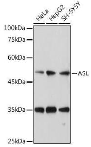 Antibody anti-ASL 100 µl