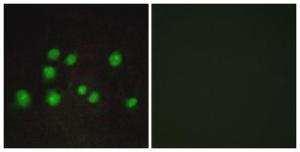 Immunofluorescence analysis of A549 cells using Anti-ELOA2 Antibody. The right hand panel represents a negative control, where the antibody was pre-incubated with the immunising peptide.