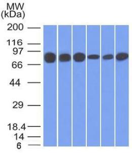 Western blot analysis of HT20, 293, A431, MCF-7, HepG2, and A549 cell lysates using Anti-gamma Catenin Antibody [15F11]