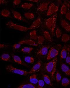 Confocal immunofluorescence analysis of U-2 OS cells using Anti-MTX1 / MTX Antibody (A306624) at a dilution of 1:100. DAPI was used to stain the cell nuclei (blue).