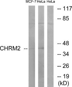 Western blot analysis of lysates from HeLa and MCF-7 cells using Anti-CHRM2 Antibody. The right hand lane represents a negative control, where the antibody is blocked by the immunising peptide.