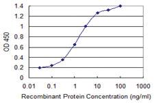 Anti-STAT6 Mouse Monoclonal Antibody [clone: 4G7]