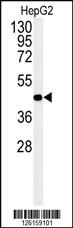 Anti-NR5A1 Rabbit Polyclonal Antibody