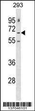 Anti-GABRE Rabbit Polyclonal Antibody