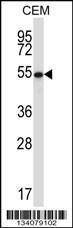 Anti-GABPA Rabbit Polyclonal Antibody (AP (Alkaline Phosphatase))