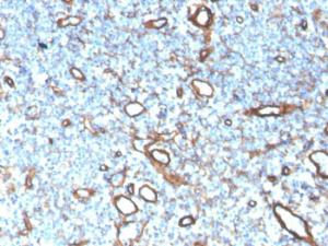 Immunohistochemical analysis of formalin-fixed, paraffin-embedded human tonsil using Anti-Collagen IV Antibody [COL4/4241R]