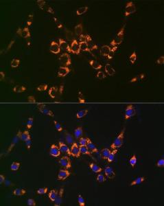 Antibody anti-ASL 100 µl