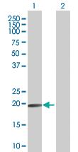 Anti-EPB41L4A Mouse Polyclonal Antibody