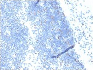 Immunohistochemical analysis of formalin-fixed, paraffin-embedded human lymph node tissue using Anti-Geminin Antibody [GMNN/4033]