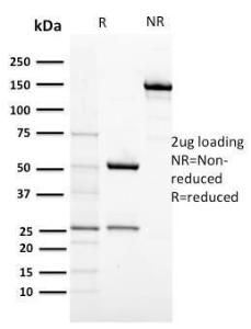 SDS-PAGE analysis of Anti-c-Kit Antibody [KIT/2674] under non-reduced and reduced conditions; showing intact IgG and intact heavy and light chains, respectively. SDS-PAGE analysis confirms the integrity and purity of the antibody