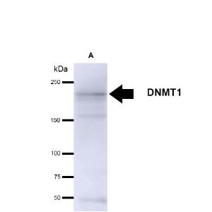 Western blot analysis of human 293T cell lysates showing detection of ~180kDa DNMT1 protein using Anti-DNMT1 Antibody [60B1220.1] (A304715) at 1:1,000 for 2 hours at room temperature