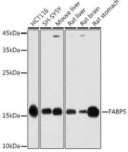 Western blot analysis of extracts of various cell lines, using Anti-FABP5 Antibody (A11968) at 1:1,000 dilution