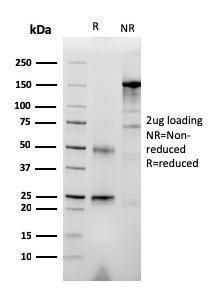 SDS-PAGE analysis of Anti-RET Antibody [RET/2976] under non-reduced and reduced conditions; showing intact IgG and intact heavy and light chains, respectively. SDS-PAGE analysis confirms the integrity and purity of the antibody.