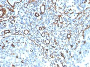 Immunohistochemical analysis of formalin-fixed, paraffin-embedded human tonsil using Anti-Collagen IV Antibody [COL4/4241R]