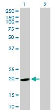 Anti-EPB41L4A Mouse Polyclonal Antibody