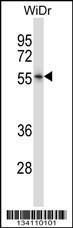 Anti-NR2E3 Rabbit Polyclonal Antibody (PE (Phycoerythrin))