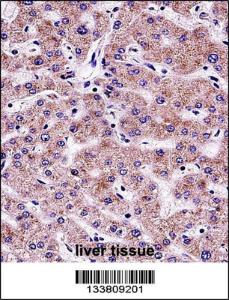 Anti-SYT6 Rabbit Polyclonal Antibody (FITC (Fluorescein Isothiocyanate))