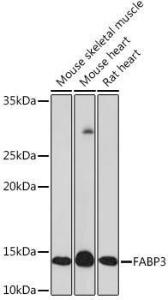 Anti-H-FABP Rabbit Monoclonal Antibody [clone: ARC1302]