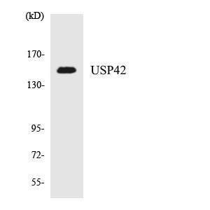 Western blot analysis of the lysates from HeLa cells using Anti-USP42 Antibody