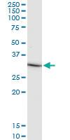 Anti-IL1B Mouse Monoclonal Antibody [clone: 2A8]