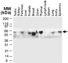 Anti-BID Rabbit Polyclonal Antibody