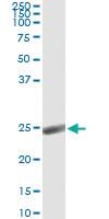 Anti-ORM1 Antibody Pair