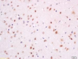 Anti-SFRS7/9G8/SRp20 Rabbit Polyclonal Antibody