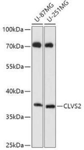 Western blot analysis of extracts of various cell lines, using Anti-CLVS2 Antibody (A306627) at 1:1000 dilution