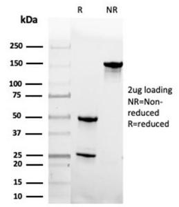 SDS-PAGE analysis of Anti-Geminin Antibody [GMNN/4033] under non-reduced and reduced conditions; showing intact IgG and intact heavy and light chains, respectively. SDS-PAGE analysis confirms the integrity and purity of the antibody