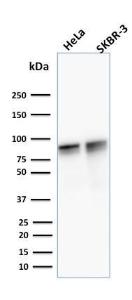 Western blot analysis of human HeLa and SK-BR-3 cell lysates using Anti-gamma Catenin Antibody [15F11]