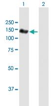 Anti-NEDD4L Mouse Polyclonal Antibody