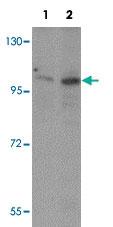 Anti-ZMIZ2 Rabbit Polyclonal Antibody