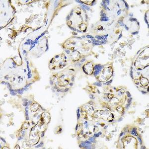 Immunohistochemistry analysis of paraffin-embedded human placenta using Anti-FABP5 Antibody (A11968) at a dilution of 1:200 (40X lens). Perform high pressure antigen retrieval with 10 mM citrate buffer pH 6.0 before commencing with IHC staining protocol