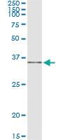 Anti-IL1B Mouse Monoclonal Antibody [clone: 2A8]