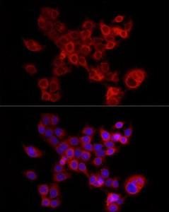 Immunofluorescence analysis of HCT116 cells using Anti-FABP5 Antibody (A11968) at a dilution of 1:200 (40X lens). DAPI was used to stain the cell nuclei (blue)