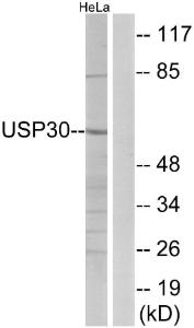 Western blot analysis of lysates from HeLa cells using Anti-USP30 Antibody. The right hand lane represents a negative control, where the antibody is blocked by the immunising peptide.