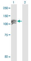 Anti-NEDD4L Mouse Monoclonal Antibody [clone: 1D2]