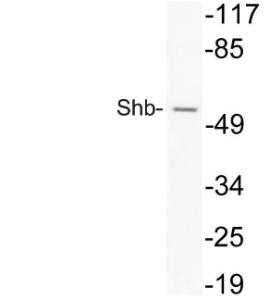 Antibody anti-SHB A99701-100 100 µg