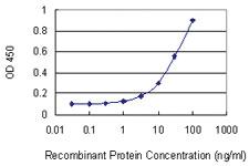 Anti-ACD Mouse Monoclonal Antibody [clone: 1C11-1A7]