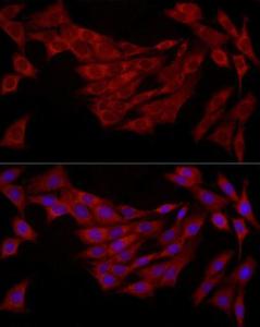 Immunofluorescence analysis of NIH/3T3 cells using Anti-FABP5 Antibody (A11968) at a dilution of 1:200 (40X lens). DAPI was used to stain the cell nuclei (blue)