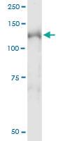 Anti-NEDD4L Mouse Monoclonal Antibody [clone: 1D2]